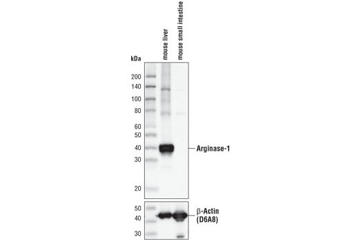  Image 14: Mouse Reactive M1 vs M2 Macrophage IHC Antibody Sampler Kit
