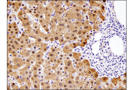  Image 35: Mouse Reactive M1 vs M2 Macrophage IHC Antibody Sampler Kit