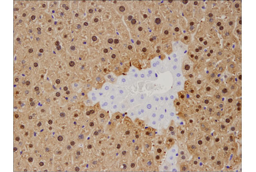 Immunohistochemistry Image 5: Arginase-1 (D4E3M™) XP® Rabbit mAb