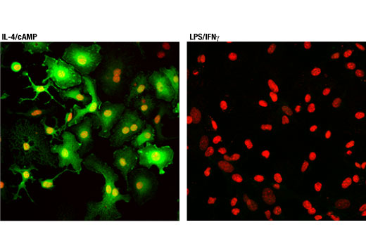  Image 65: Mouse Reactive M1 vs M2 Macrophage IHC Antibody Sampler Kit