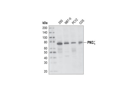  Image 4: PKC Isoform Antibody Sampler Kit