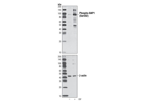 Western Blotting Image 1: Phospho-BAP1 (Ser592) Antibody