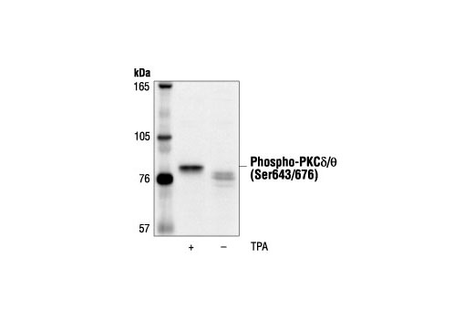  Image 7: Phospho-PKC Antibody Sampler Kit