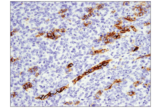 Immunohistochemistry Image 2: EpCAM (E6V8Y) XP® Rabbit mAb (Mouse Preferred)
