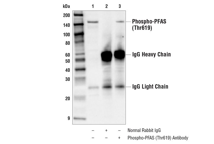 Immunoprecipitation Image 1: Phospho-PFAS (Thr619) Antibody