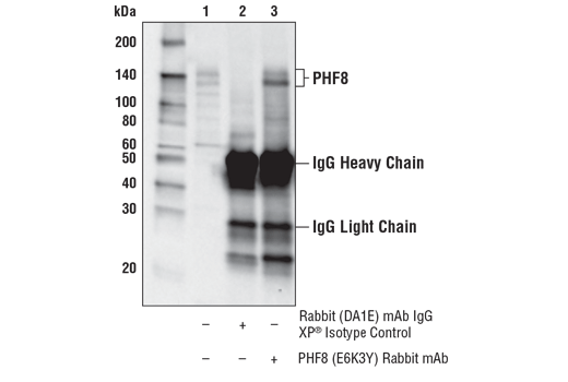 Immunoprecipitation Image 1: PHF8 (E6K3Y) Rabbit mAb