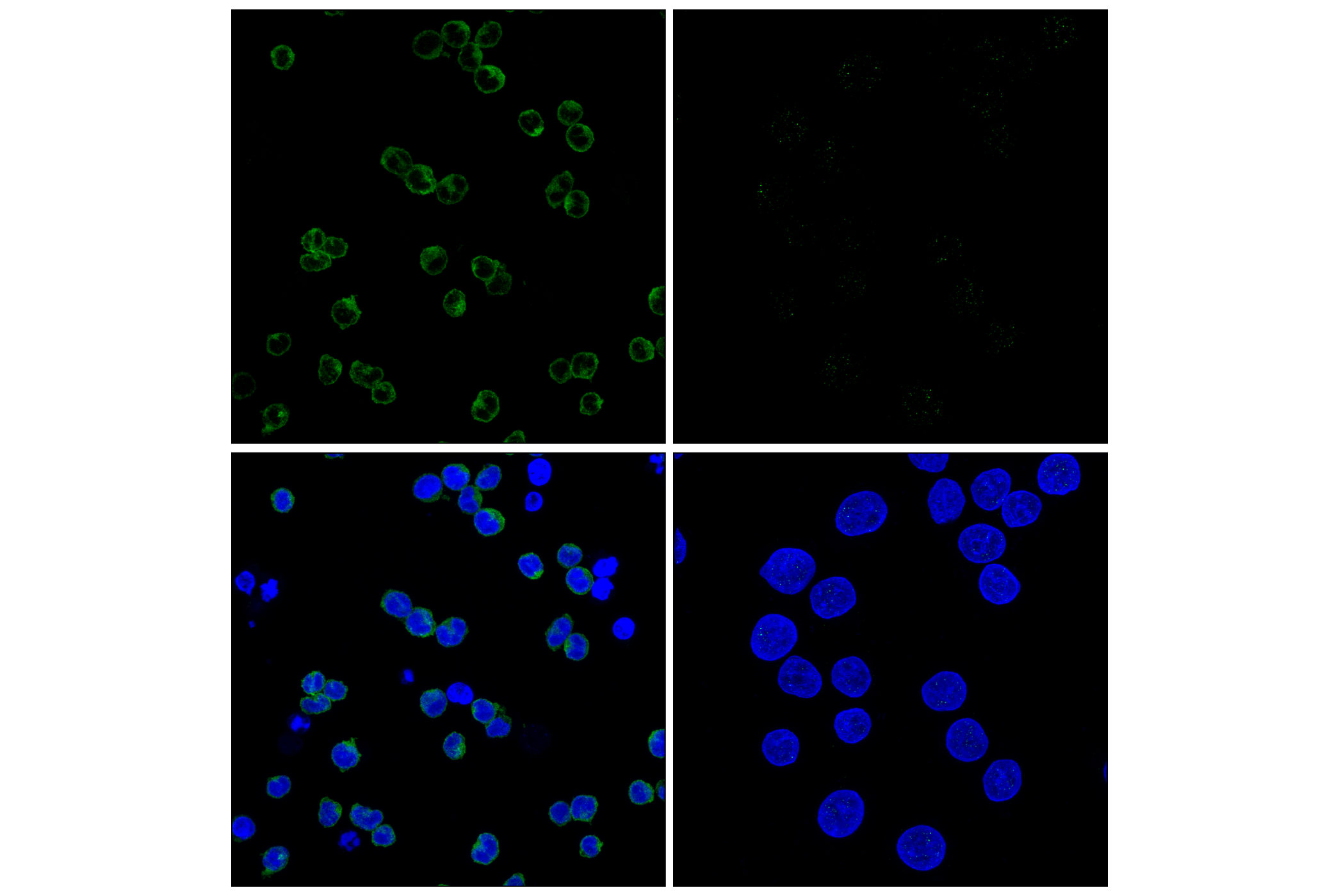 Immunofluorescence Image 1: Gab1 (E8U1S) Rabbit mAb