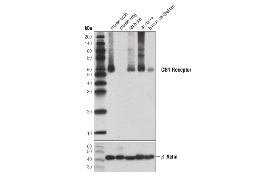  Image 12: Cannabinoid Receptor 1 Downstream Signaling Antibody Sampler Kit