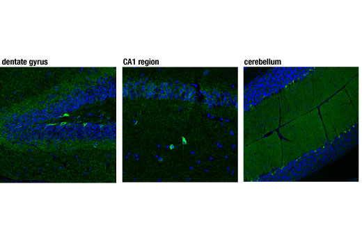 Immunofluorescence Image 1: CB1 Receptor (D5N5C) Rabbit mAb