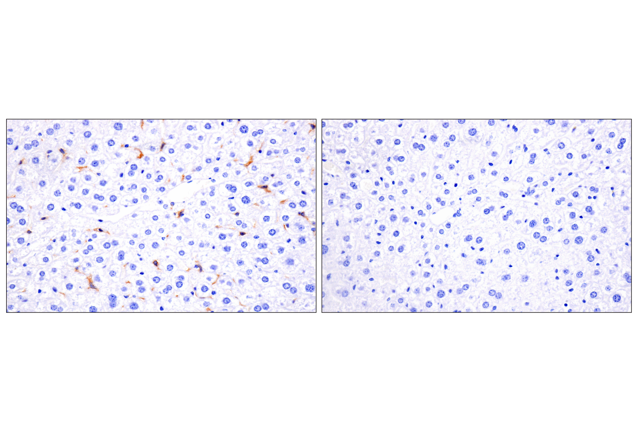 Immunohistochemistry Image 10: CD14 (D1U2Y) Rabbit mAb