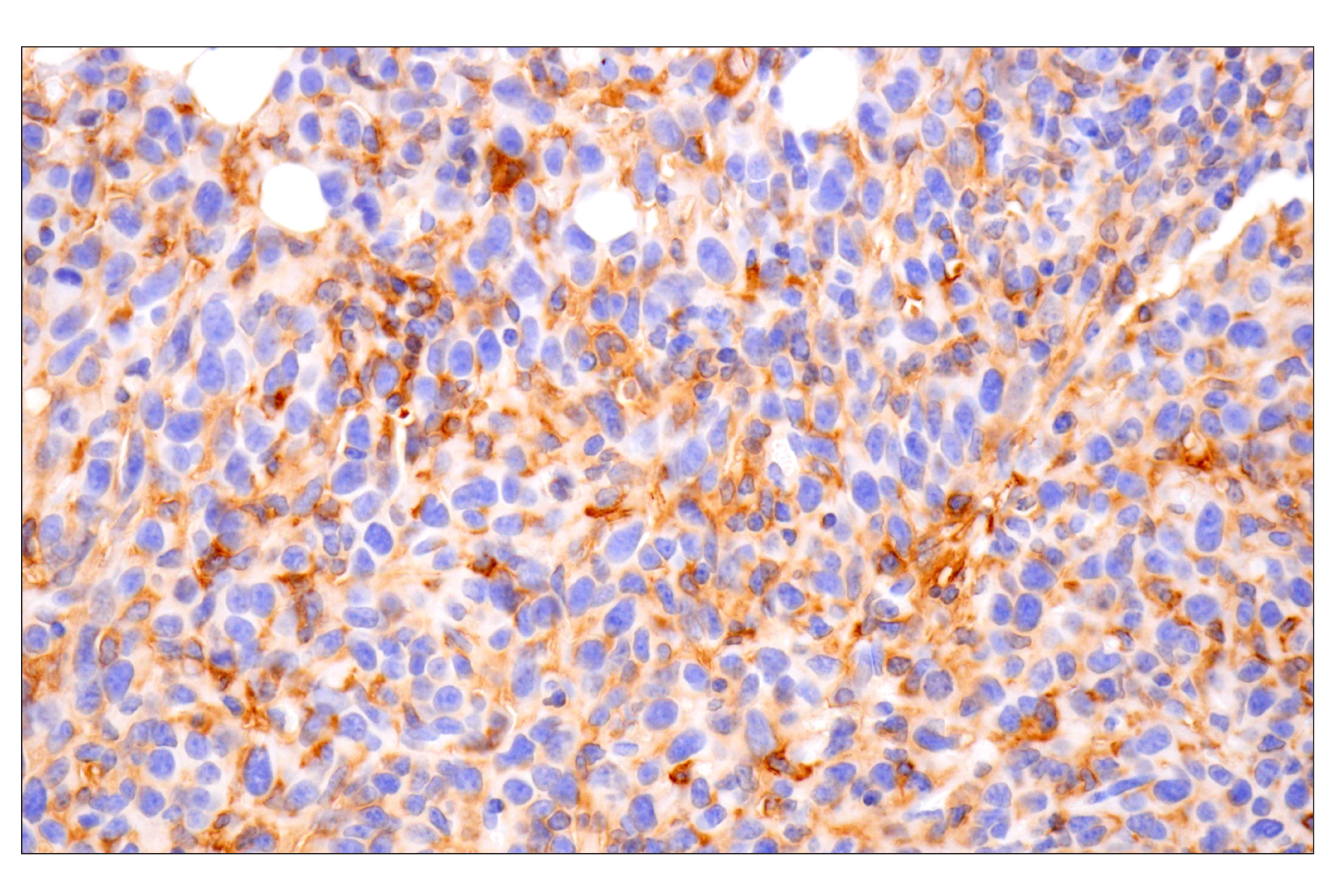 Immunohistochemistry Image 1: CD14 (D1U2Y) Rabbit mAb