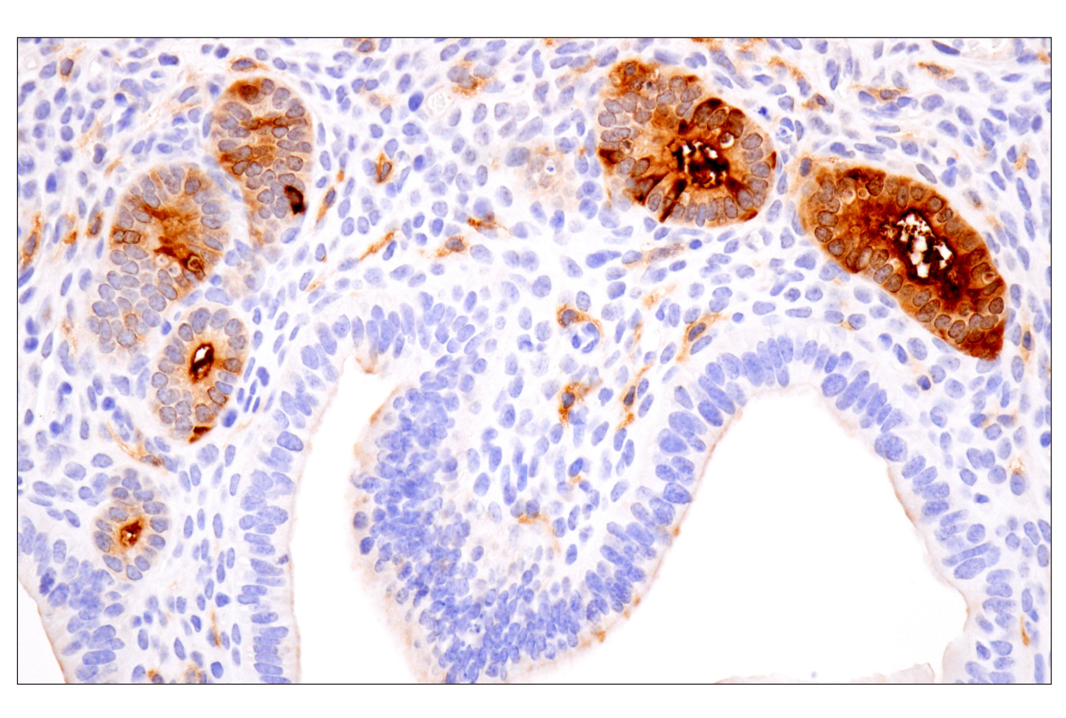 Immunohistochemistry Image 6: CD14 (D1U2Y) Rabbit mAb