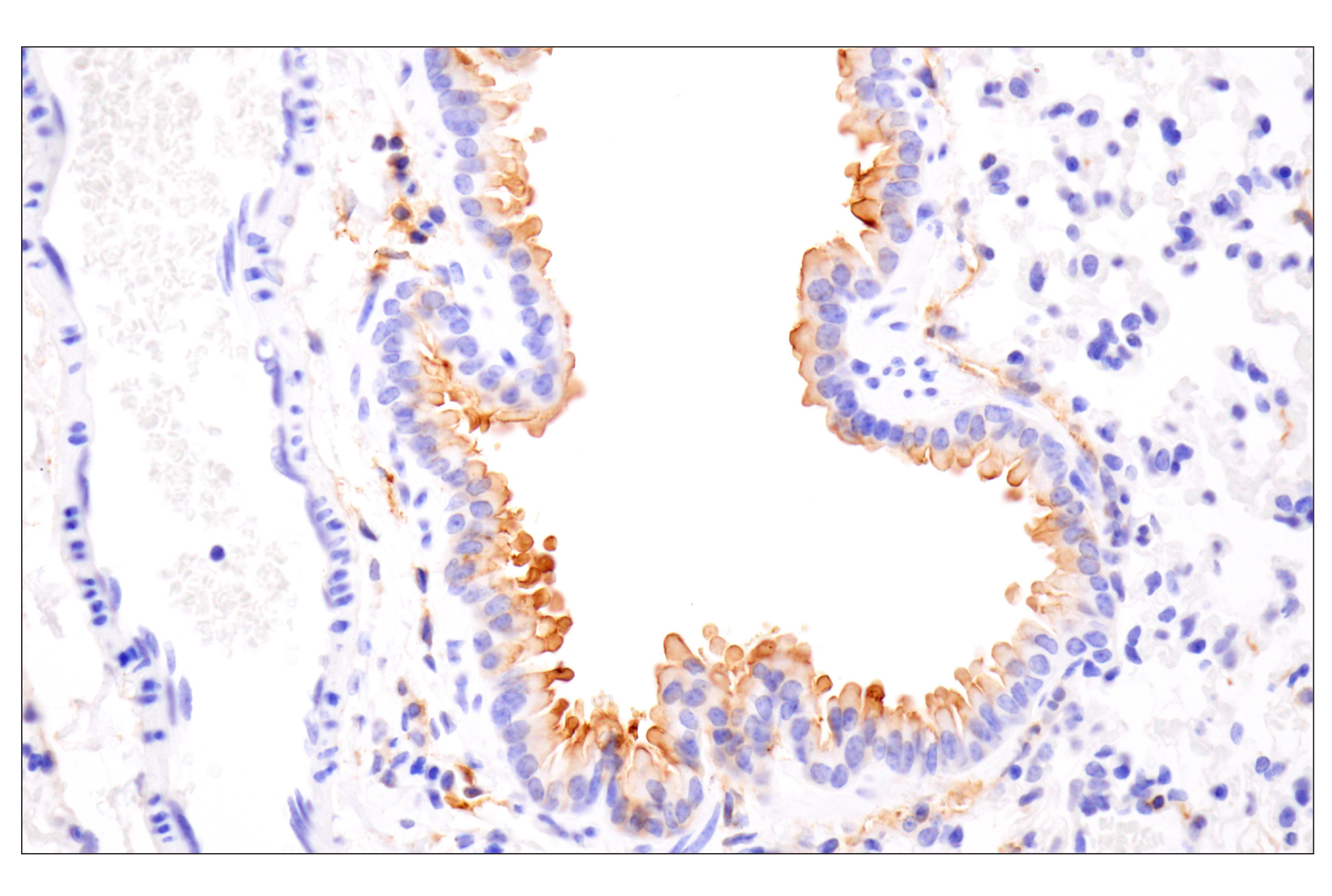 Immunohistochemistry Image 9: CD14 (D1U2Y) Rabbit mAb