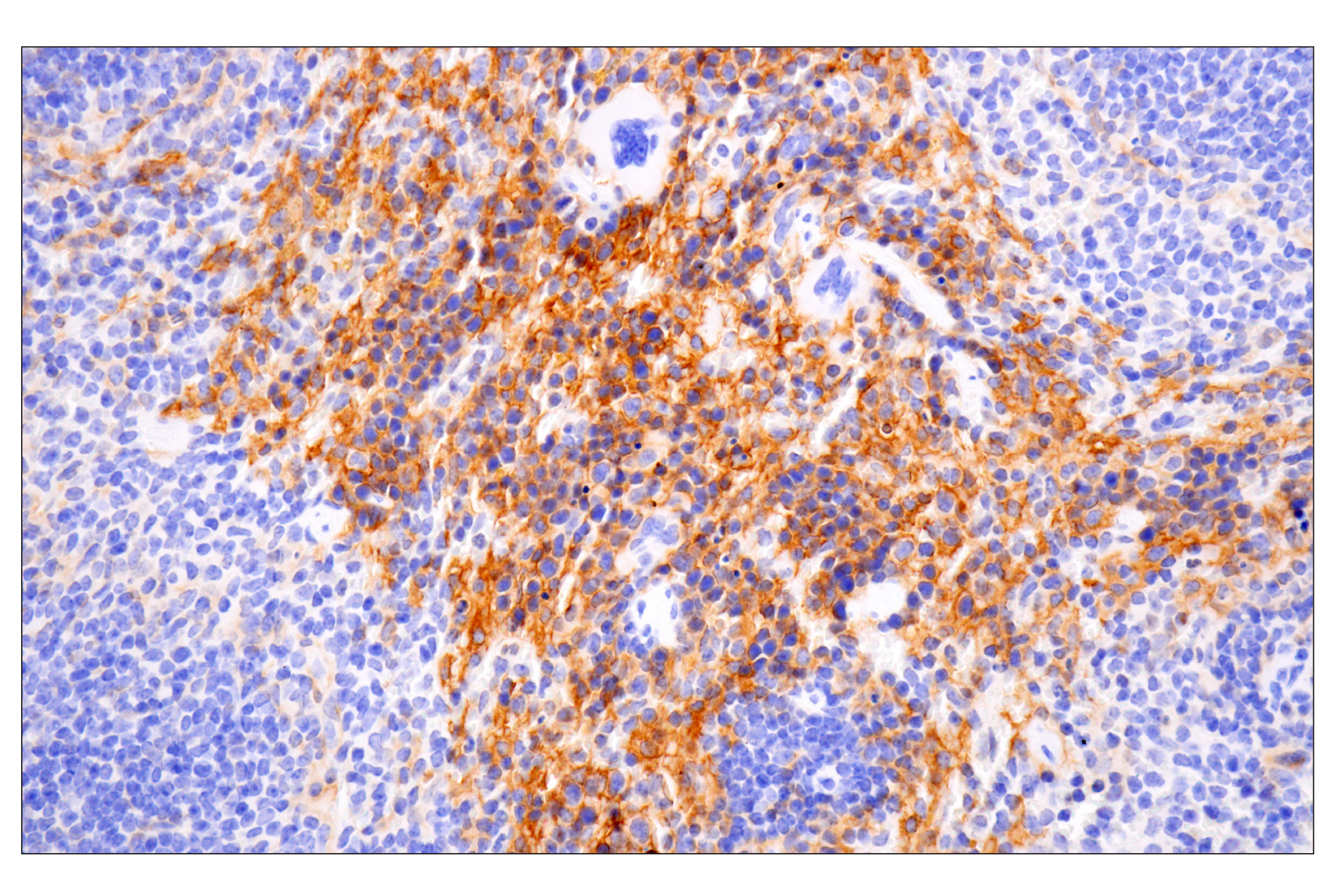 Immunohistochemistry Image 5: CD14 (D1U2Y) Rabbit mAb