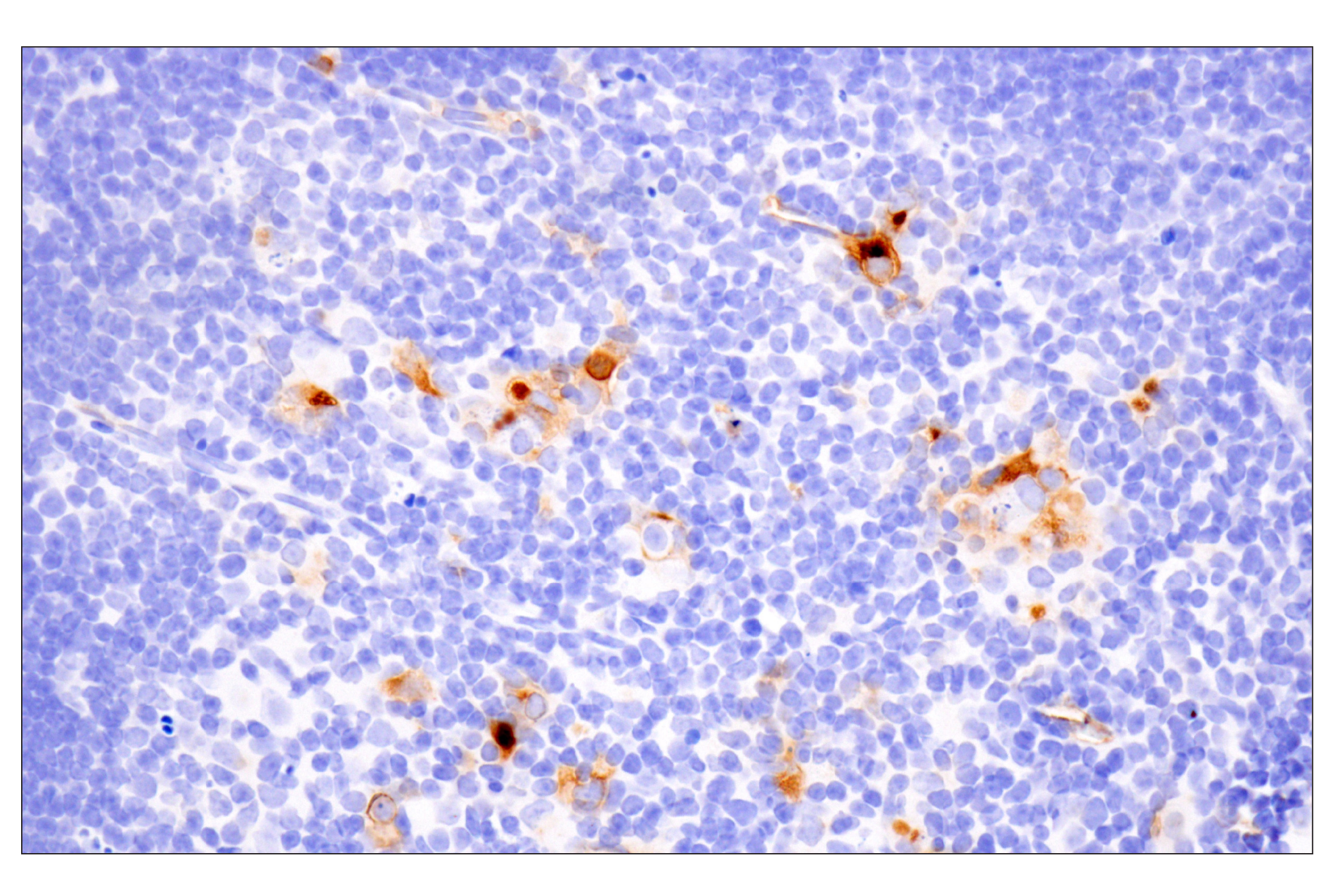 Immunohistochemistry Image 8: CD14 (D1U2Y) Rabbit mAb