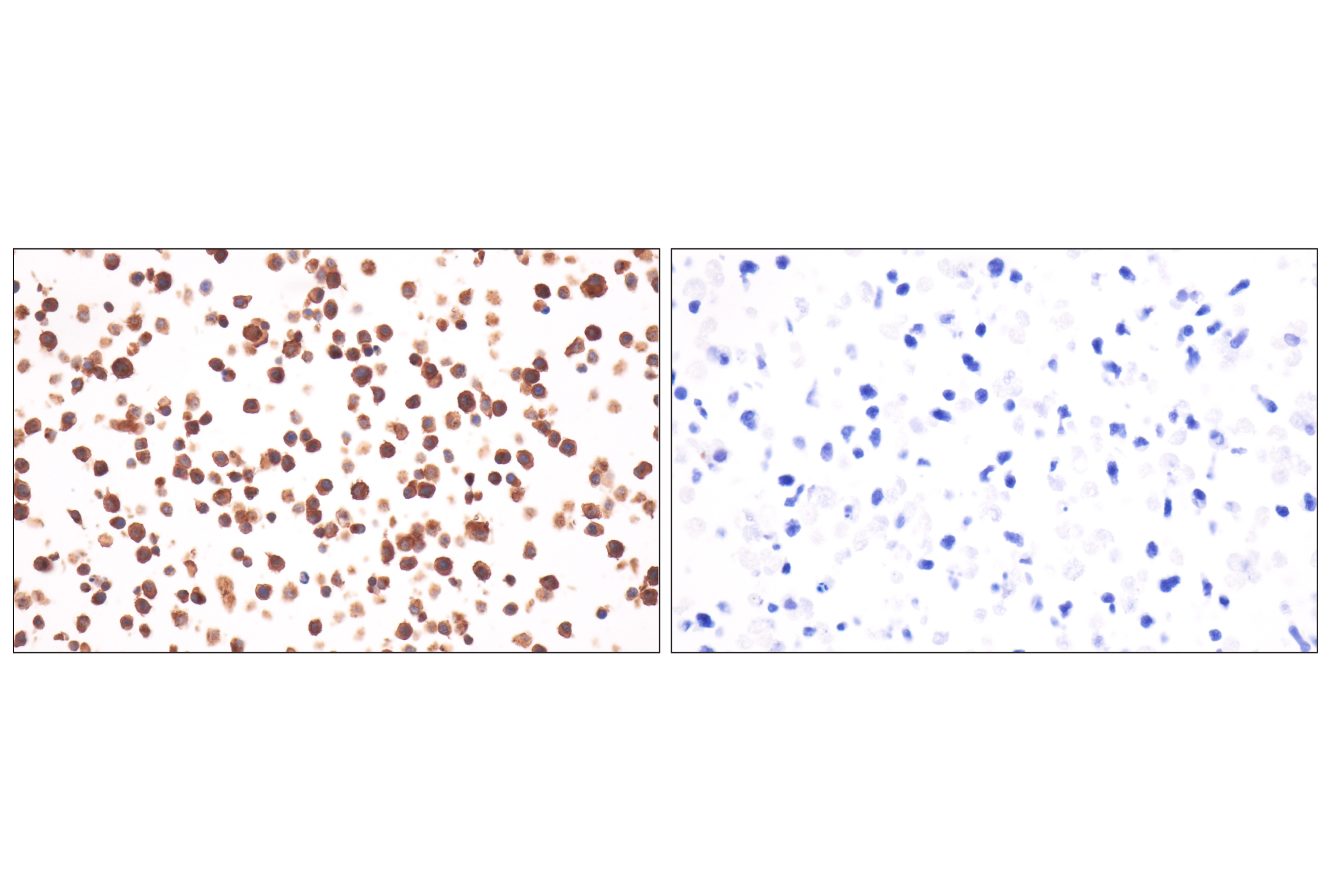 Immunohistochemistry Image 11: CD14 (D1U2Y) Rabbit mAb