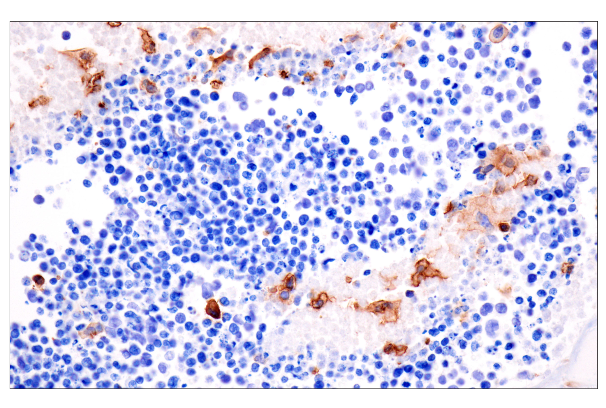 Immunohistochemistry Image 4: CD14 (D1U2Y) Rabbit mAb