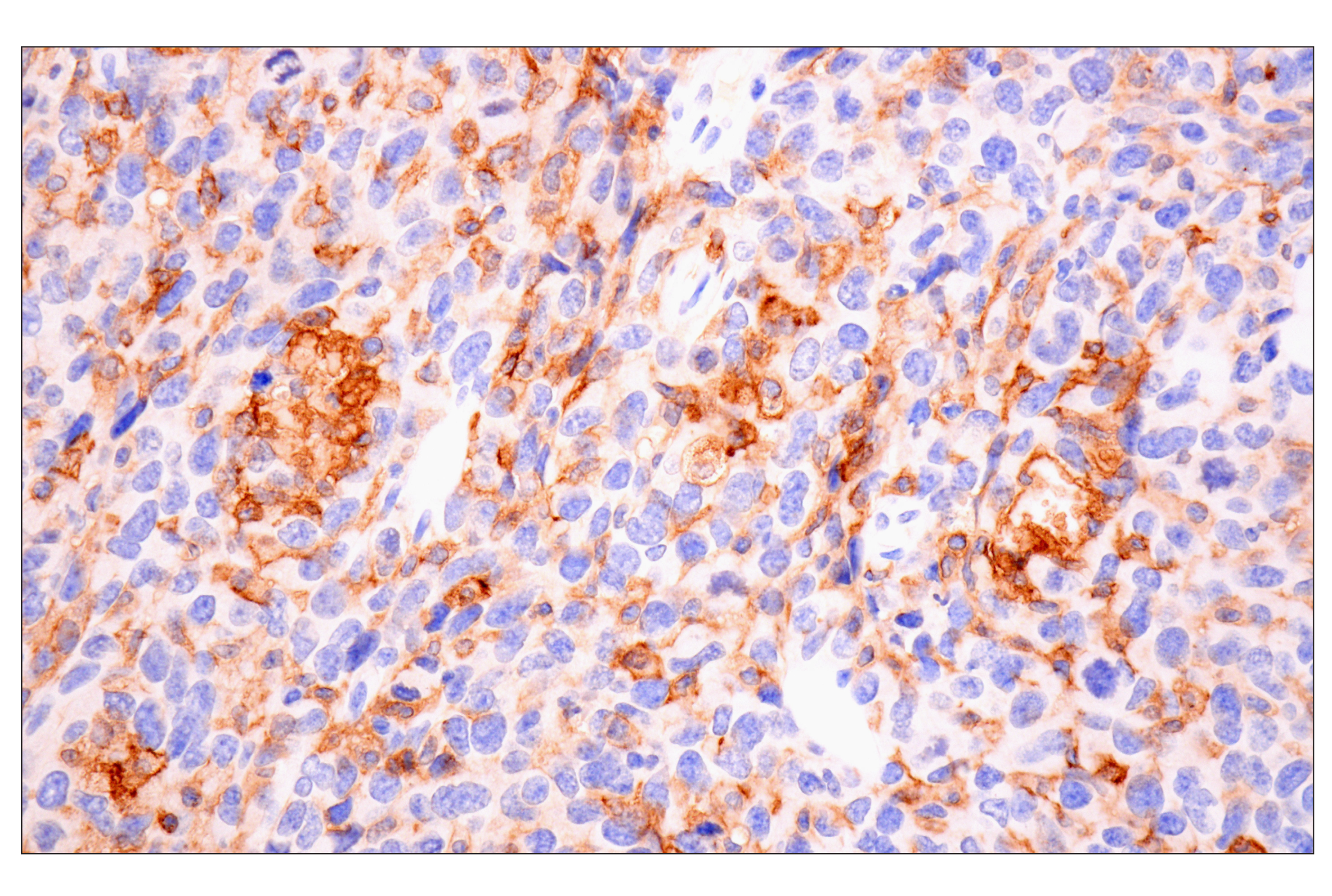 Immunohistochemistry Image 3: CD14 (D1U2Y) Rabbit mAb