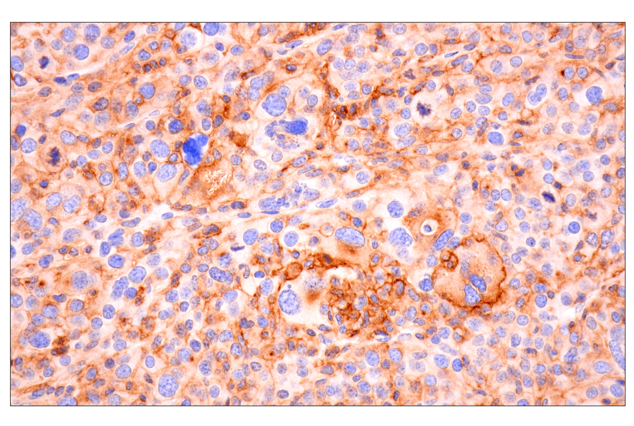 Immunohistochemistry Image 2: CD14 (D1U2Y) Rabbit mAb