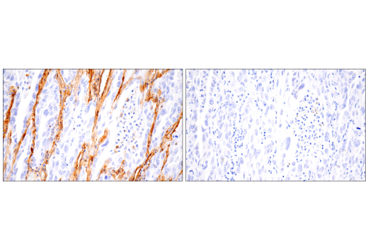 Immunohistochemistry Image 7: Integrin α1/CD49a (E9K2J) XP® Rabbit mAb (BSA and Azide Free)