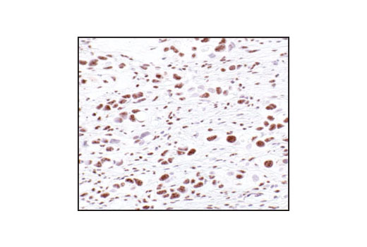 Immunohistochemistry Image 1: Phospho-Threonine-Proline Mouse mAb (P-Thr-Pro-101)