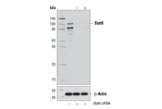  Image 1: SignalSilence® Stat6 siRNA I (Mouse Specific)