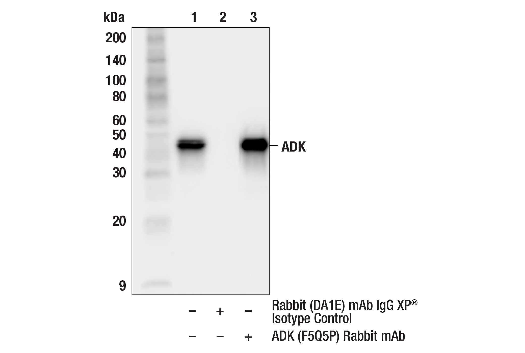 Immunoprecipitation Image 1: ADK (F5Q5P) Rabbit mAb