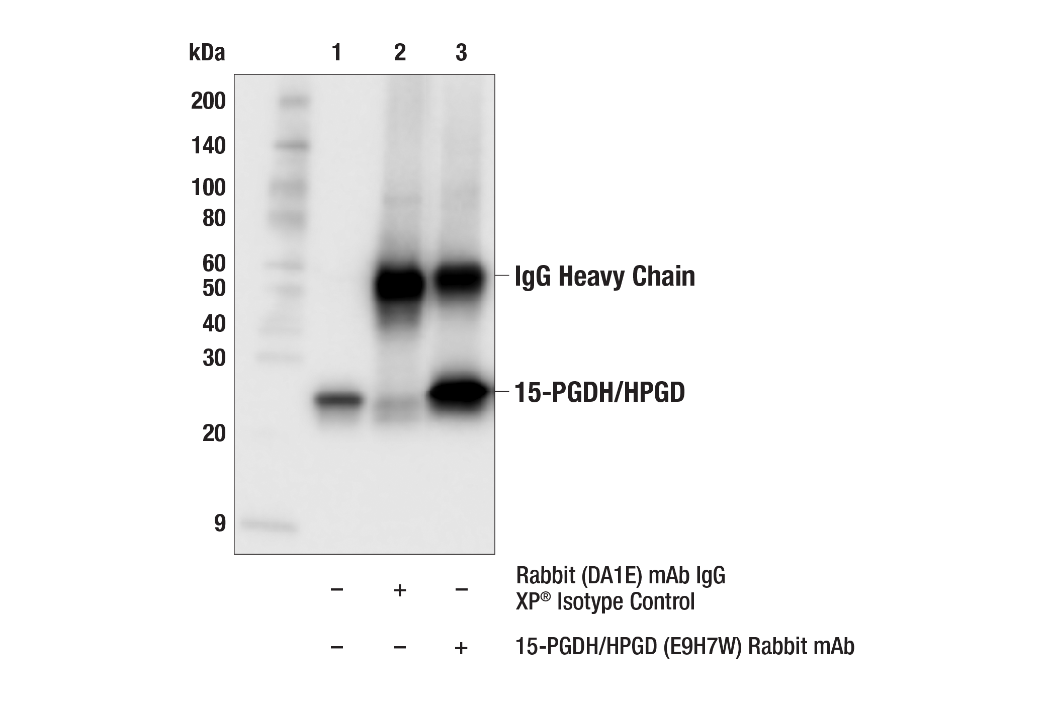 Immunoprecipitation Image 1: 15-PGDH/HPGD (E9H7W) Rabbit mAb