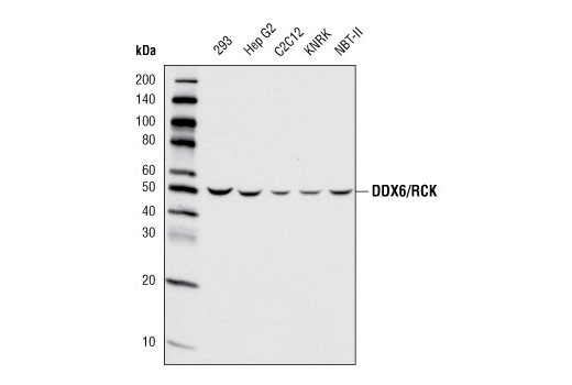 Western Blotting Image 1: DDX6/RCK Antibody