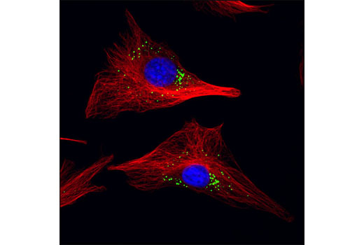 Immunofluorescence Image 1: DDX6/RCK Antibody