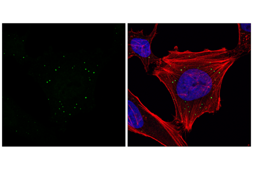 Immunofluorescence Image 2: DDX6/RCK Antibody