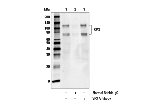 Immunoprecipitation Image 1: SP3 Antibody