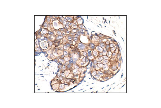 Immunohistochemistry Image 1: Phospho-Tyrosine Mouse mAb (P-Tyr-100)