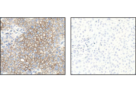 Immunohistochemistry Image 3: Phospho-Tyrosine Mouse mAb (P-Tyr-100)
