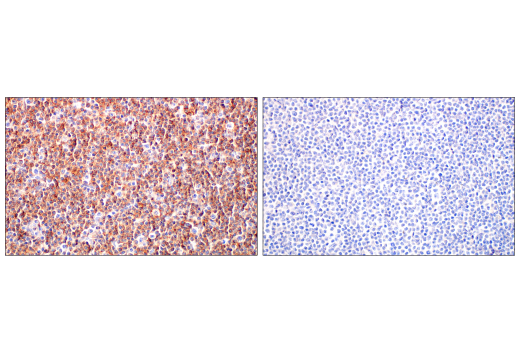 Immunohistochemistry Image 4: Phospho-Tyrosine Mouse mAb (P-Tyr-100)