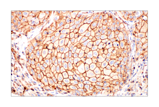 Immunohistochemistry Image 5: Phospho-Tyrosine Mouse mAb (P-Tyr-100)