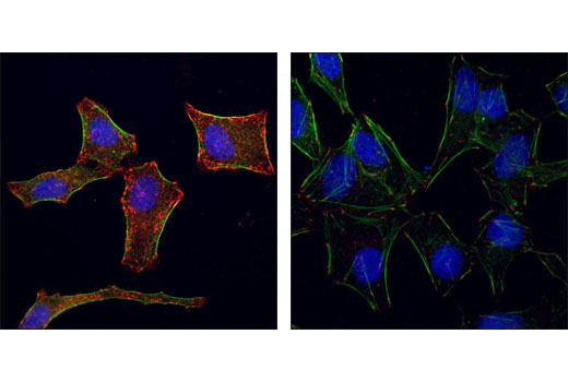 Immunofluorescence Image 4: Phospho-Tyrosine Mouse mAb (P-Tyr-100)