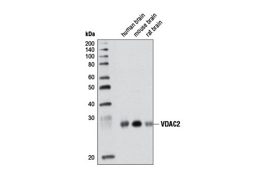 Western Blotting Image 1: VDAC2 Antibody