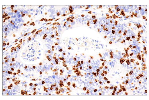 Immunohistochemistry Image 1: CD7 (LP15) Mouse mAb