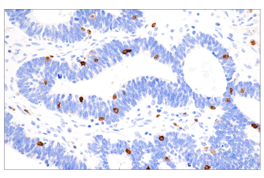Immunohistochemistry Image 3: CD7 (LP15) Mouse mAb