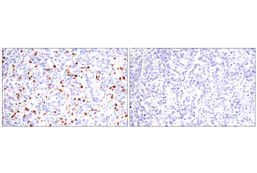 Immunohistochemistry Image 9: CD7 (LP15) Mouse mAb