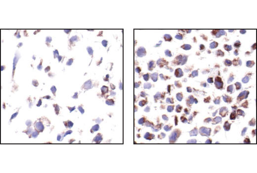 Immunohistochemistry Image 3: Phospho-Bad (Ser112) (40A9) Rabbit mAb (BSA and Azide Free)
