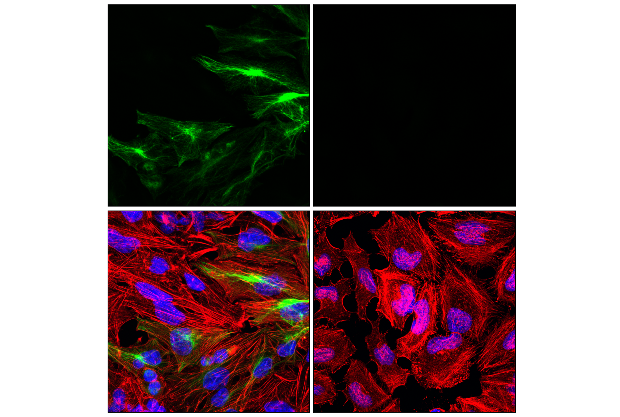Immunofluorescence Image 2: GFAP (E4L7M) XP® Rabbit mAb (Alexa Fluor® 488 Conjugate)