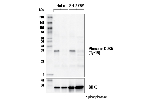 Western Blotting Image 1: Phospho-CDK5 (Tyr15) Antibody