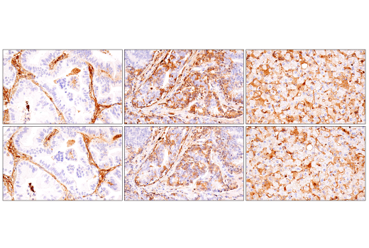 Immunohistochemistry Image 9: IgM (E9U8J) XP® Rabbit mAb (BSA and Azide Free)