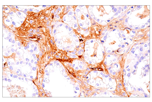Immunohistochemistry Image 7: IgM (E9U8J) XP® Rabbit mAb (BSA and Azide Free)