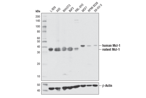  Image 18: Pro-Survival Bcl-2 Family Antibody Sampler Kit II