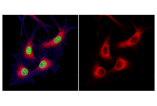 Immunofluorescence Image 1: Rab7 (D95F2) XP® Rabbit mAb (Alexa Fluor® 647 Conjugate)
