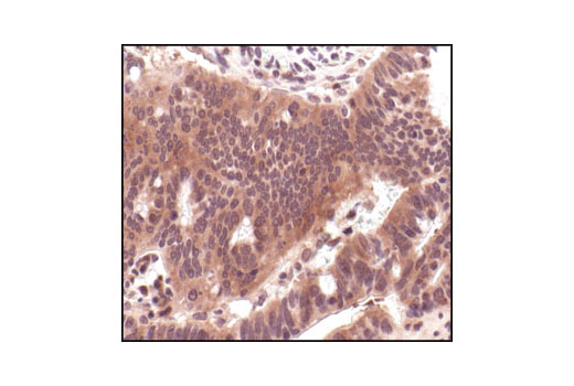 Immunohistochemistry Image 2: MEK1/2 (L38C12) Mouse mAb (BSA and Azide Free)