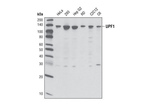 Western Blotting Image 1: UPF1 Antibody